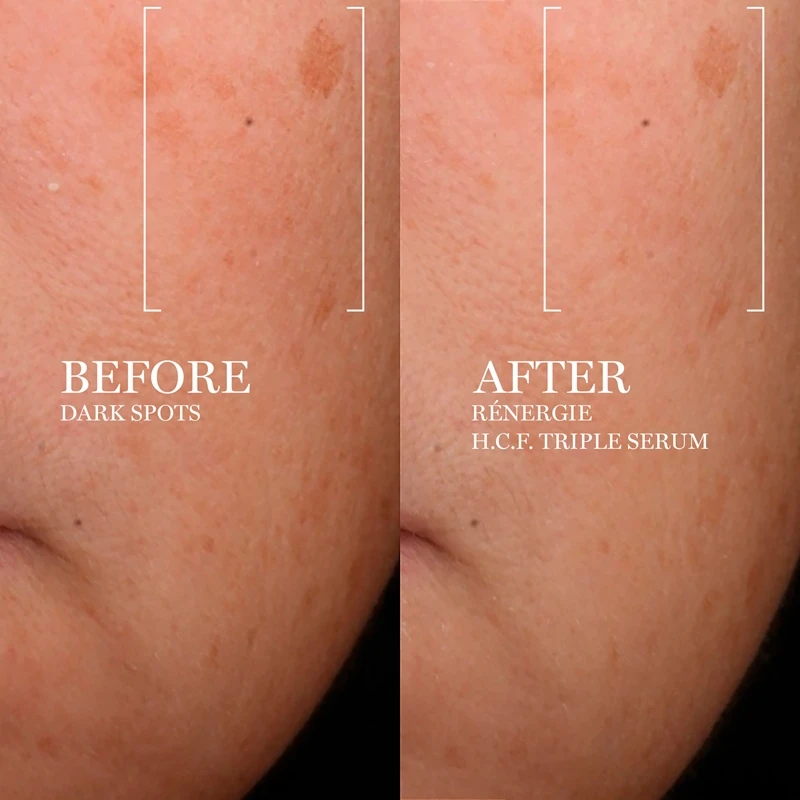 Lancome Lancôme Rénergie H.C.F. Triple Serum 7 Lancome Lancôme Rénergie H.C.F. Triple Serum – Image 5