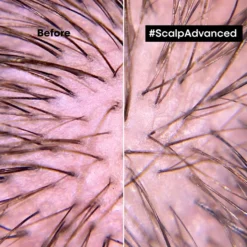 L’Oréal Professionnel Serie Expert Scalp Advanced 9 L’Oréal Professionnel Serie Expert Scalp Advanced -Promos Beau Lisse Boutique loreal professionnel serie expert scalp advanced shampoing pour cuir chevelu sensible et irrite 1