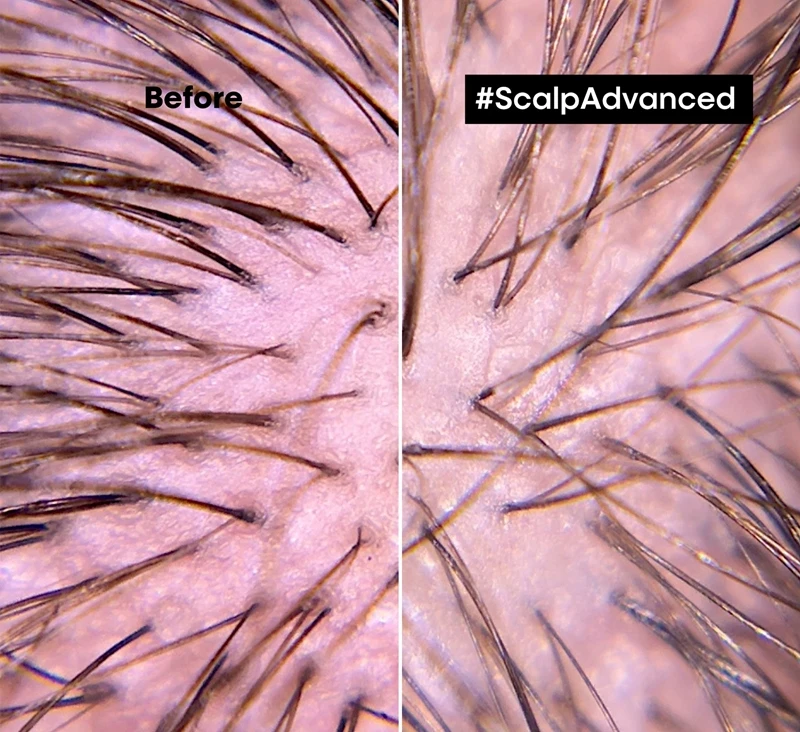 L’Oréal Professionnel Serie Expert Scalp Advanced 4 L’Oréal Professionnel Serie Expert Scalp Advanced – Image 2