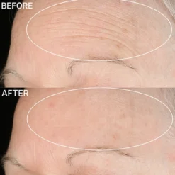 Promos Beau Lisse Boutique -Promos Beau Lisse Boutique strivectin anti wrinkle sd advanced plus creme concentree pour reduire les rides 1